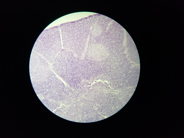 Thymus Slides - Thymus 006 100X
